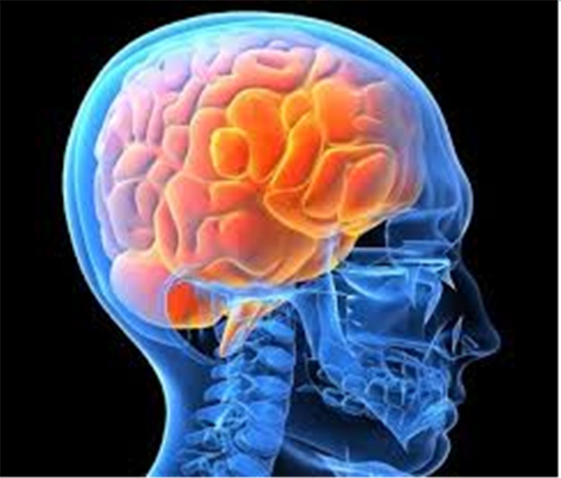 A brain tumor Parkinsons disease Median wind I