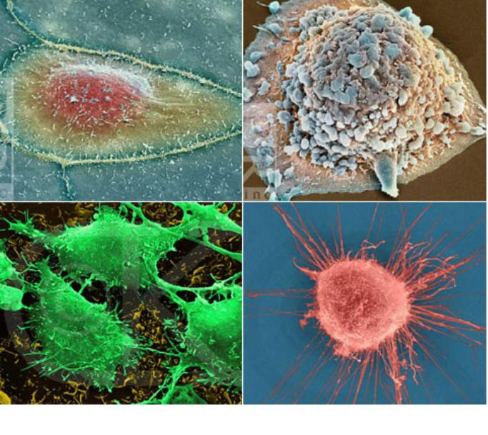 Cancer is definitely cured