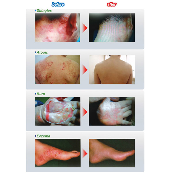 Skin diseases are also certain to be treated