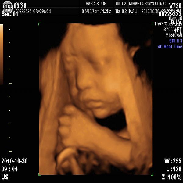 Printer Output Image