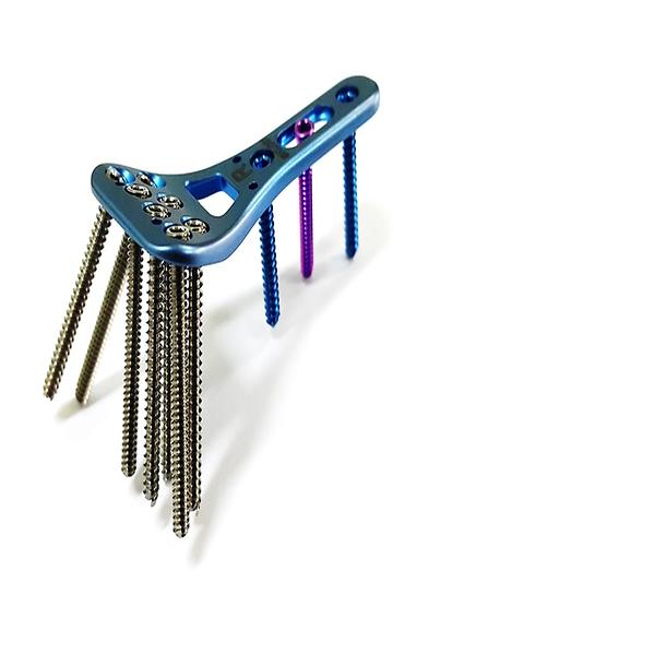 Distal Radius Plating Sys