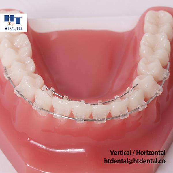 On typodont(on sale)