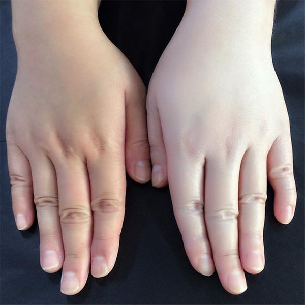 Directness in hand whiten
