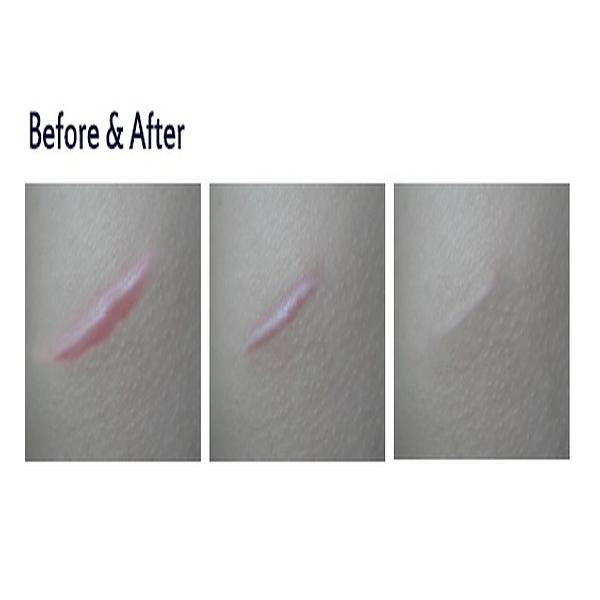 Doctor Derma Silicone gel