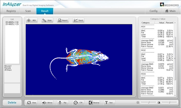 Body composition analysis