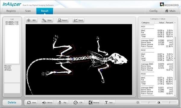 Bone image with data