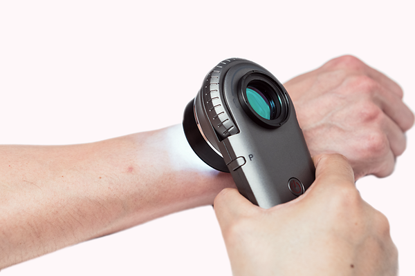 Skin Examination Device