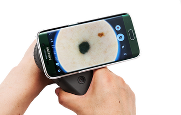 Dermoscopy Device