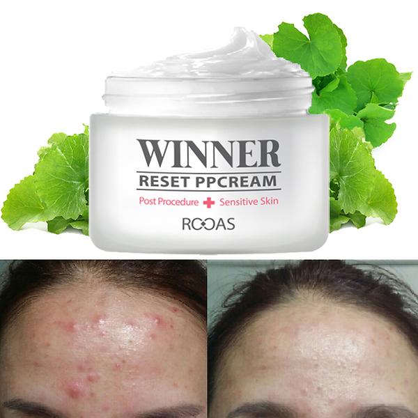 reset ppcream recommendat