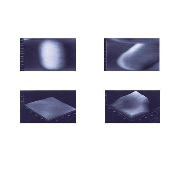 lectron microscopic view 