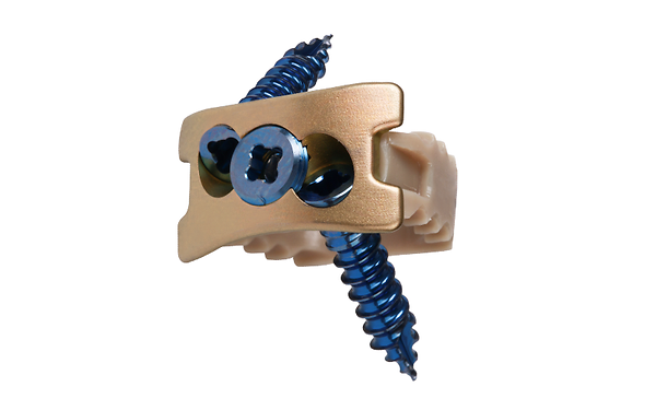 Cervical Fusion System