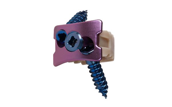 Cervical Fusion System