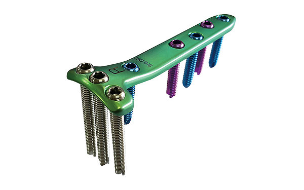 Proximal Tibia Plating Sy