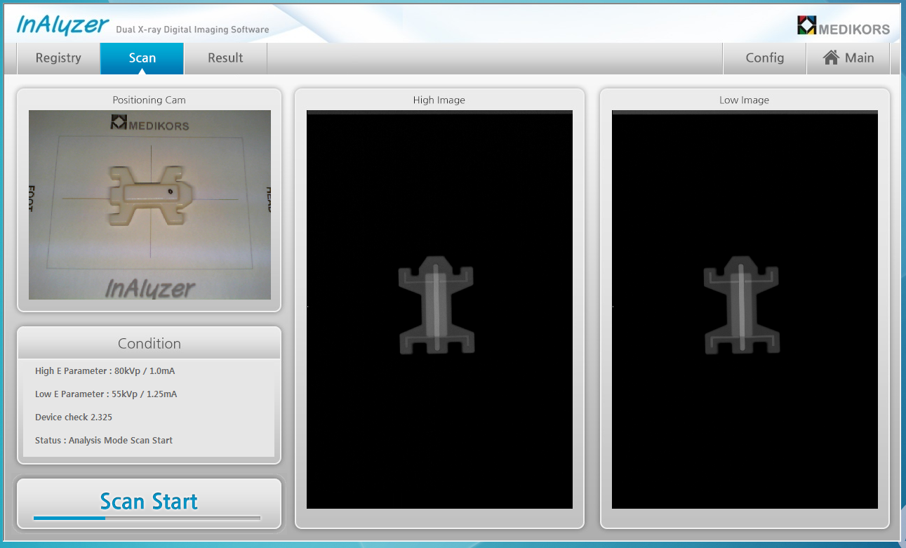 Inner camera is equippted