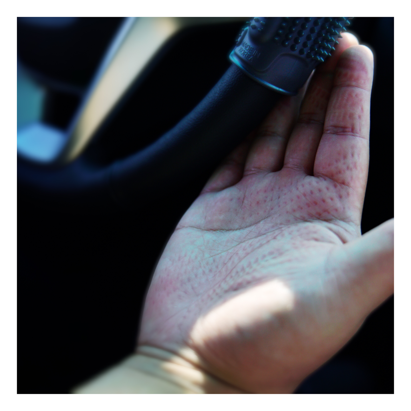 Acupressure massage stimulation effect