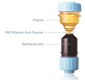 DrPRP Device