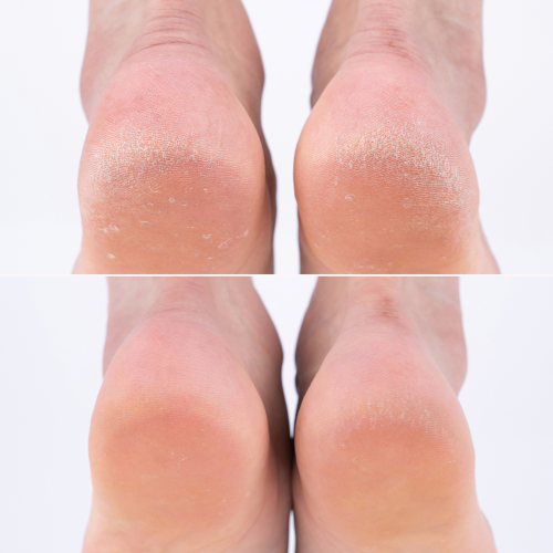 Rubelli Toe Socks Foot Pack