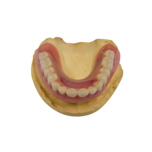 Dental stone model