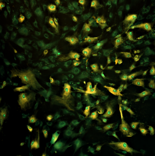 Cell image where green-colored parts represent richer GSH level