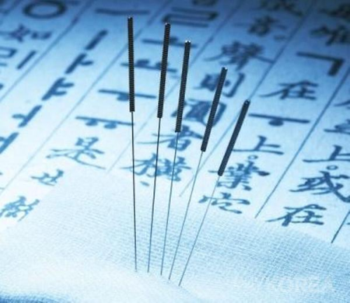 Hand acupuncture needle