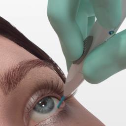 Insertion the implant into the vitreous