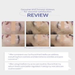 Before and After pictures donated by our customers/consumers.(for more details, please visit www.instagram.com/skinlinks and send DM to us!)