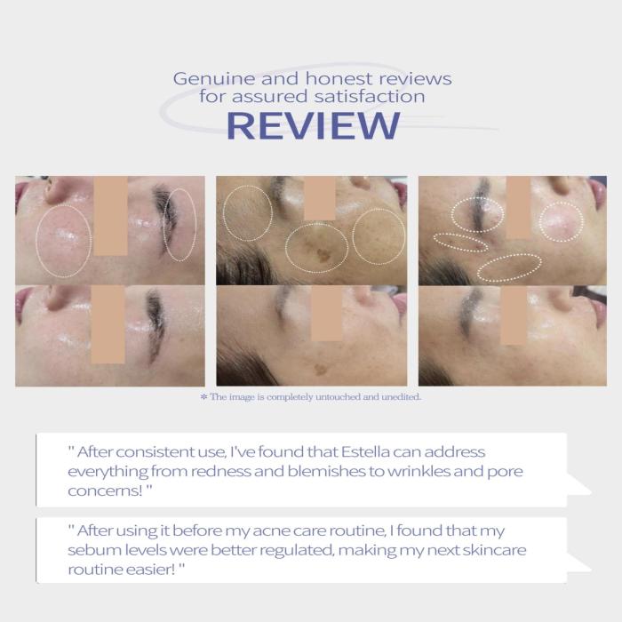 Before and After pictures donated by our customers/consumers.(for more details, please visit www.instagram.com/skinlinks and send DM to us!)