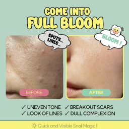 Harness the rejuvenating power of Snail Secretion Filtrate for a radiant complexion. Designed to Address Troubled, Sensitive, and Dehydrated Skin, this Snail Mucin Moisturizer Evens Out Skin Tone, Improves the Appearance of Breakout Scars and the Look of Lines.