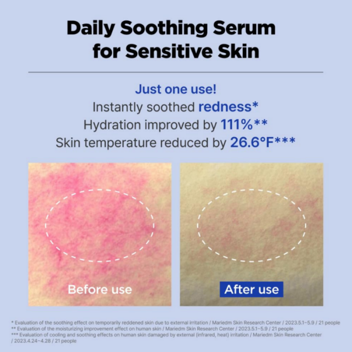 ISOI ACNI Dr. 1st Control Serum 40ml