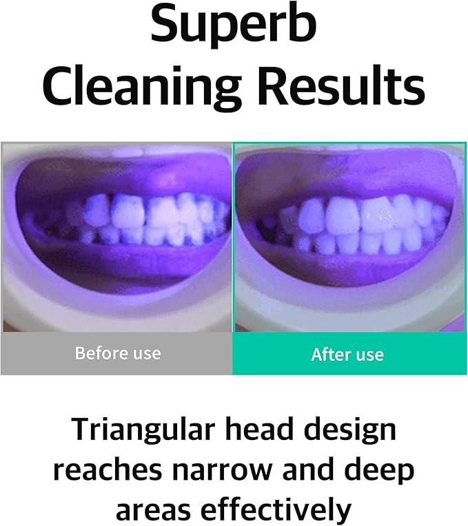 Liveorals Spiral Bristle Toothbrush