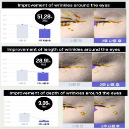 Improvement of wrinkles around the eyes