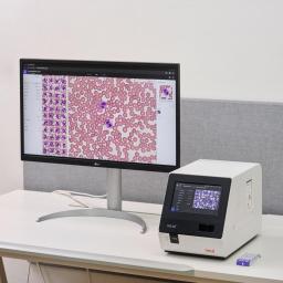 miLab Platform displaying blood analysis results.