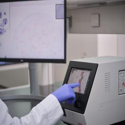 miLab Platform displaying cytology analysis results.