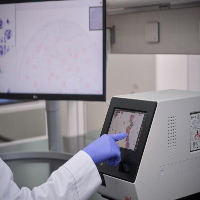miLab Platform displaying cytology analysis results.