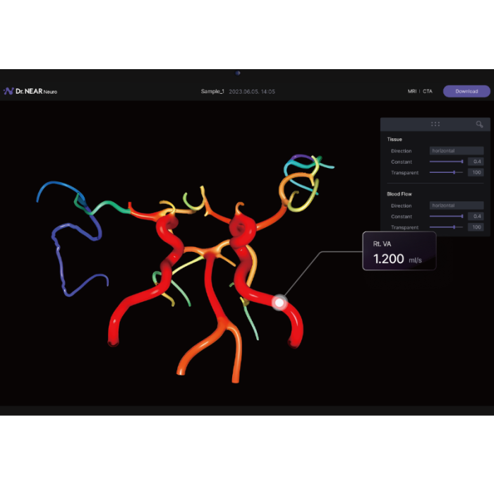 a 3D model of cerebral blood flow