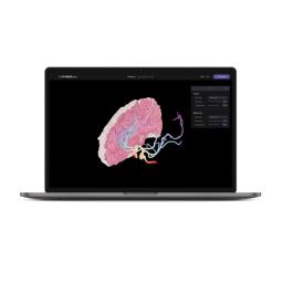 a 3D model of cerebral blood flow