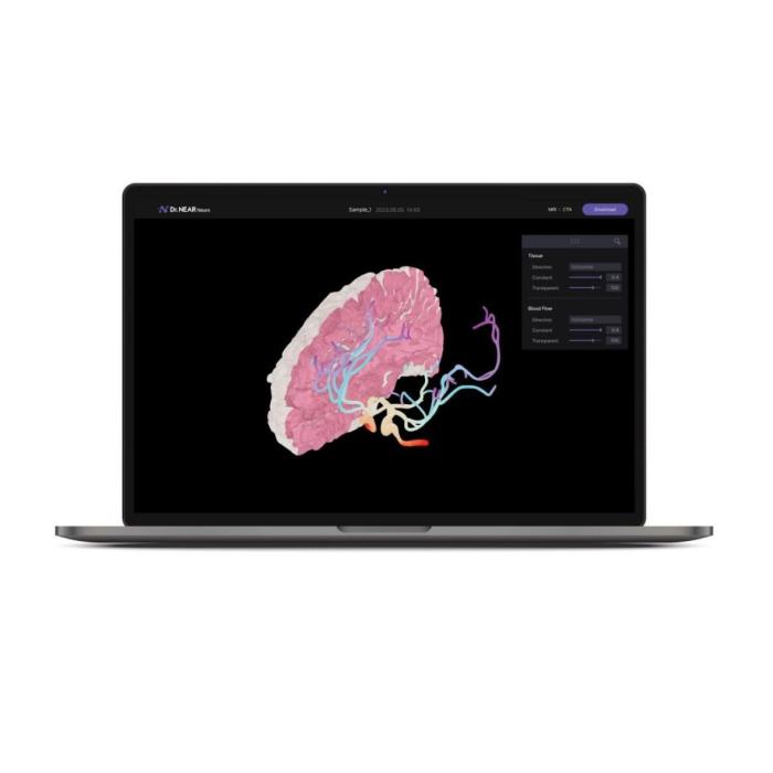 a 3D model of cerebral blood flow