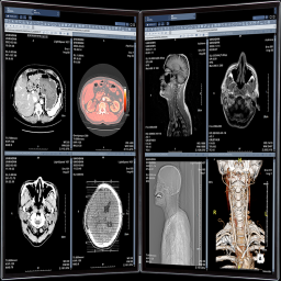Various Displays for ZeTTA PACS