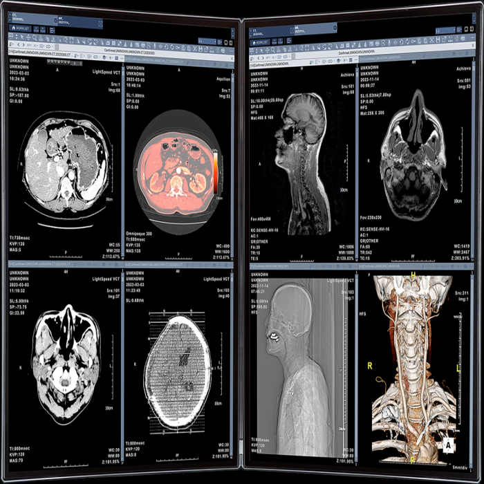 Various Displays for ZeTTA PACS