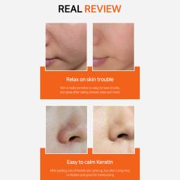 Visible improvement in skin texture and hydration after use, helping to soothe irritation and improve skin condition.