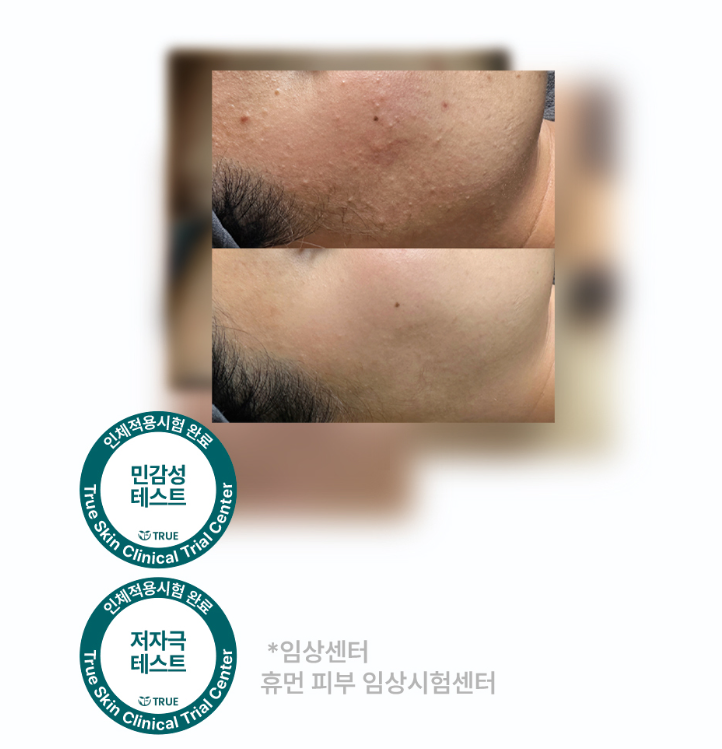 BLUE EGG PEEL | tradekorea